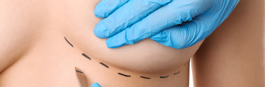 Cicatrice après réduction mammaire